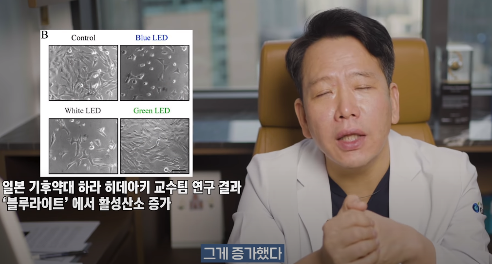 안과의사의 블루라이트 차단안경에 대한 생각 | 인스티즈