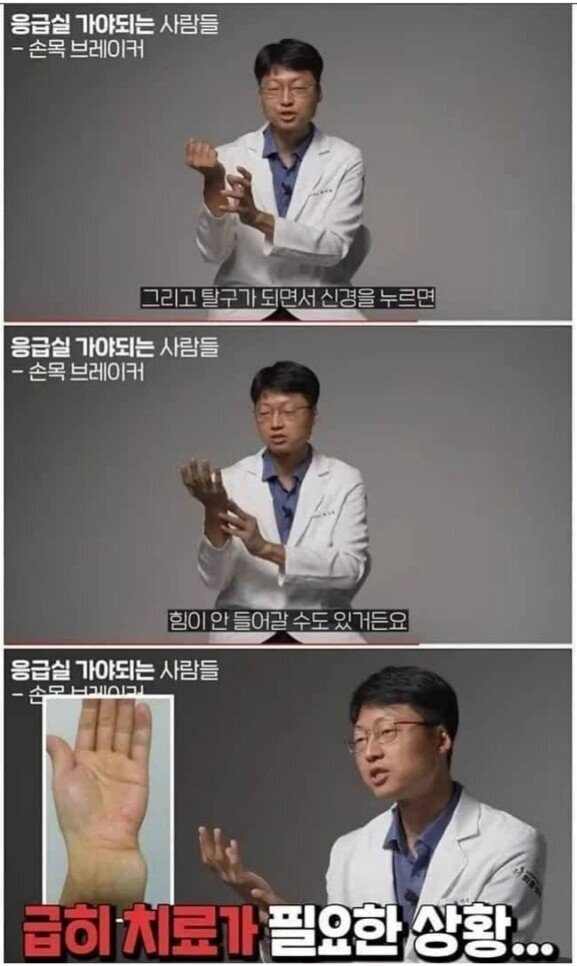 의사가 바라본 손목 브레이커.jpg | 인스티즈