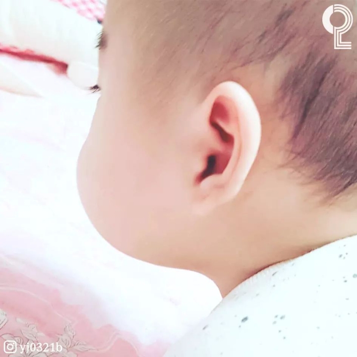 아기볼살 | 인스티즈