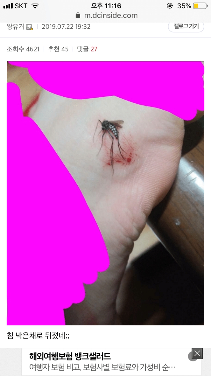 모기갤러리 미친 크기의 모기(혐주의).JPG | 인스티즈