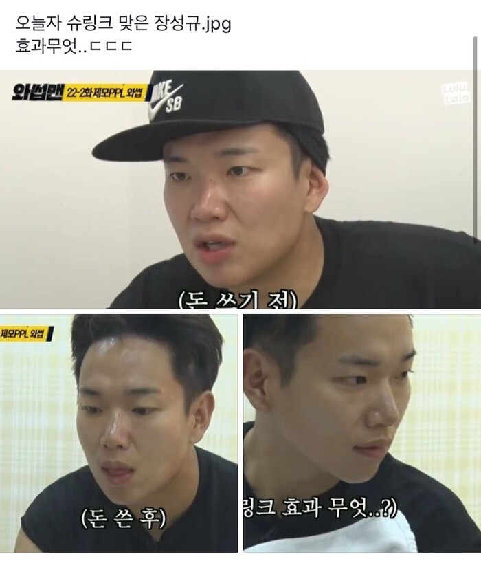 장성규 시술 전후 | 인스티즈