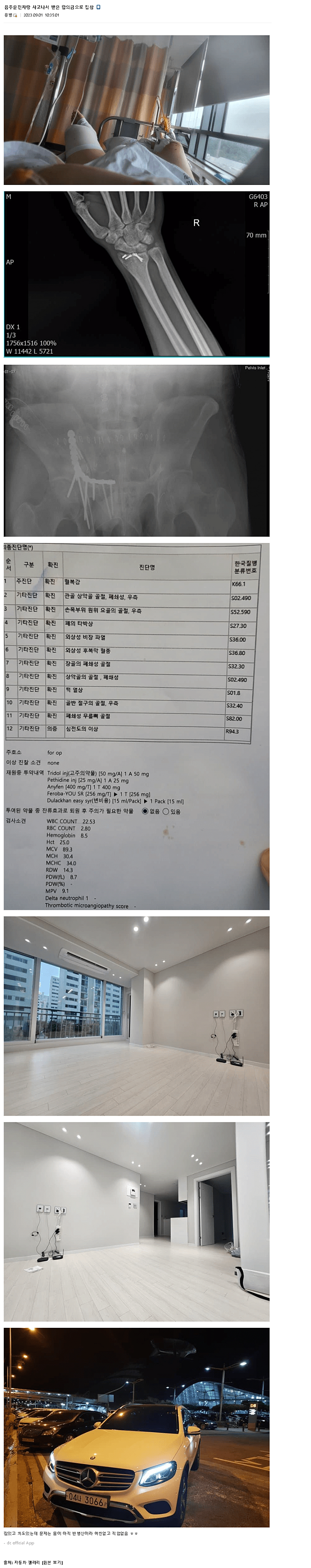 교통사고 합의금으로 집이랑 자동차 산 사람 | 인스티즈