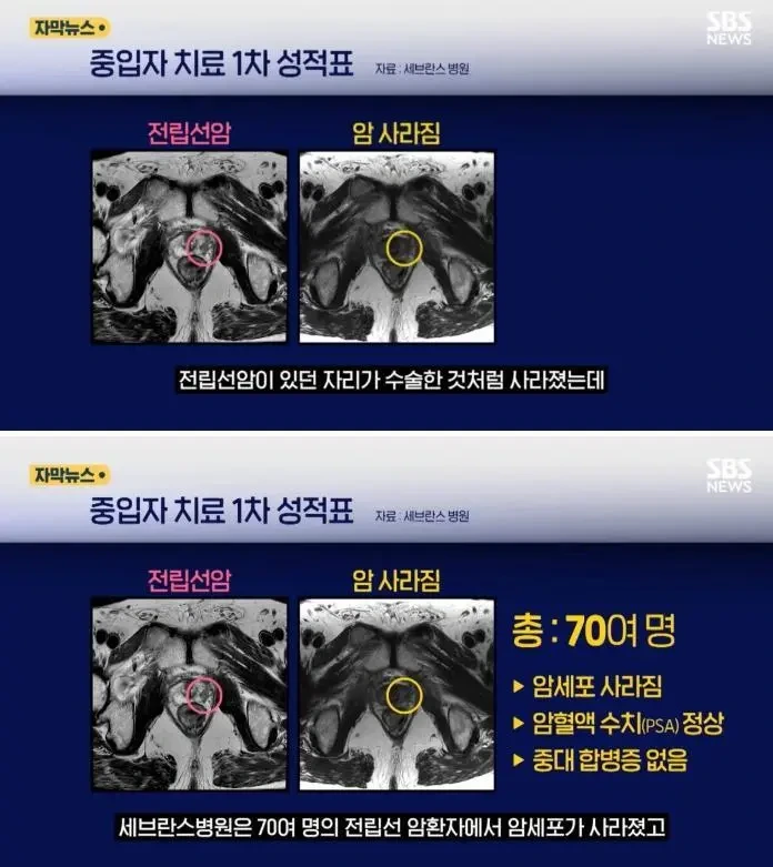 중입자 암치료 기계 근황 | 인스티즈