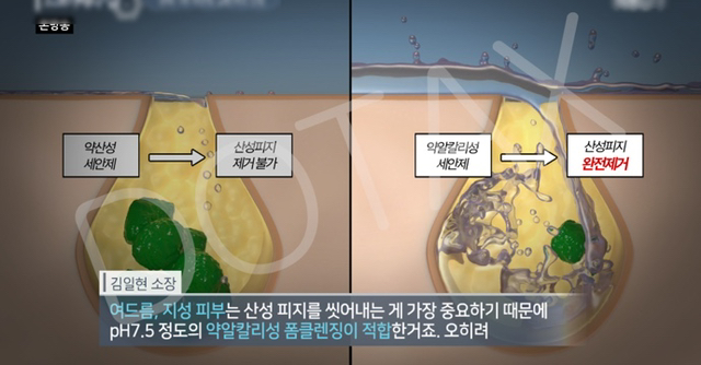 얼굴에 뭉치는 여드름 '산성피지'의 진실.jpg | 인스티즈