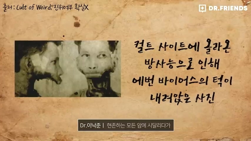 강한자도 살아남기 힘들었던 시대의 방사능 치료 | 인스티즈