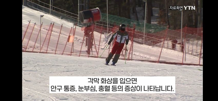 다들 겨울철 각막화상 조심하세요 | 인스티즈