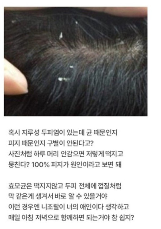 탈모라고 오해하는 질환 1위 | 인스티즈
