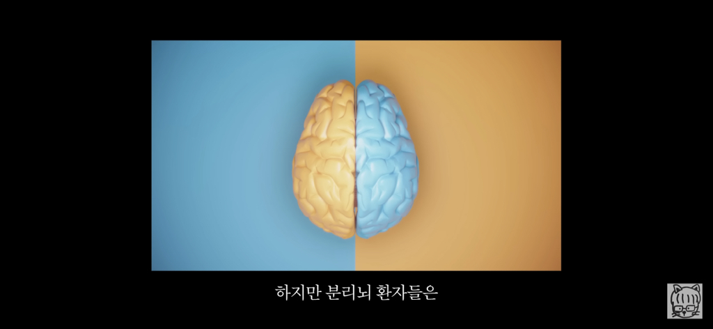(스압)분리 뇌 실험 | 인스티즈