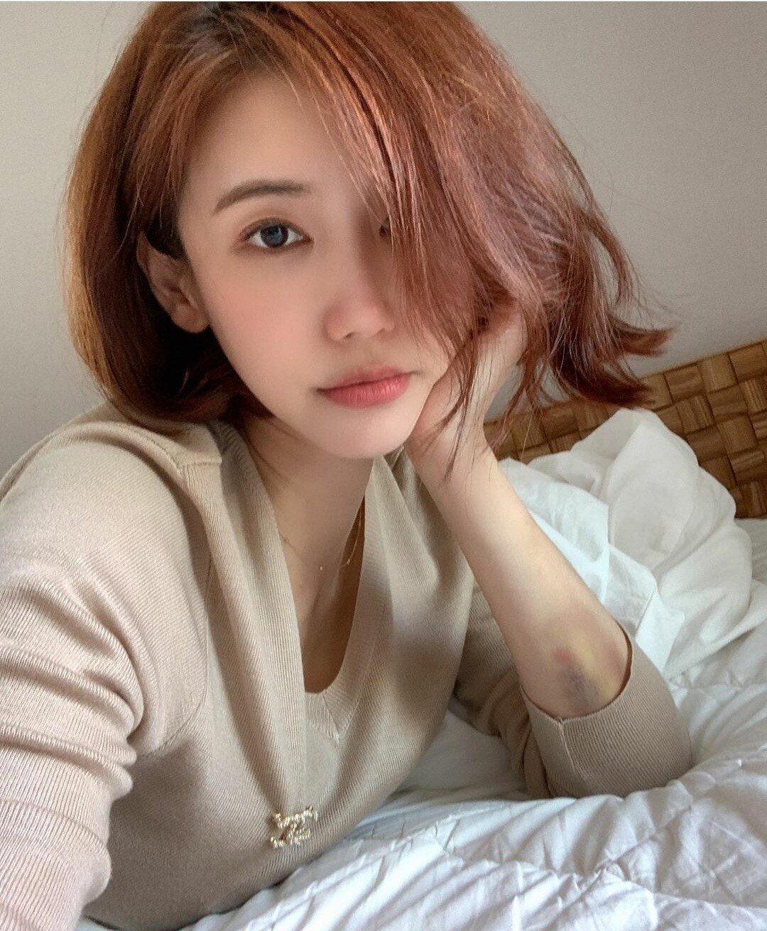 故오인혜 몸에 수상한 멍자국들 발견한 유족들 | 인스티즈