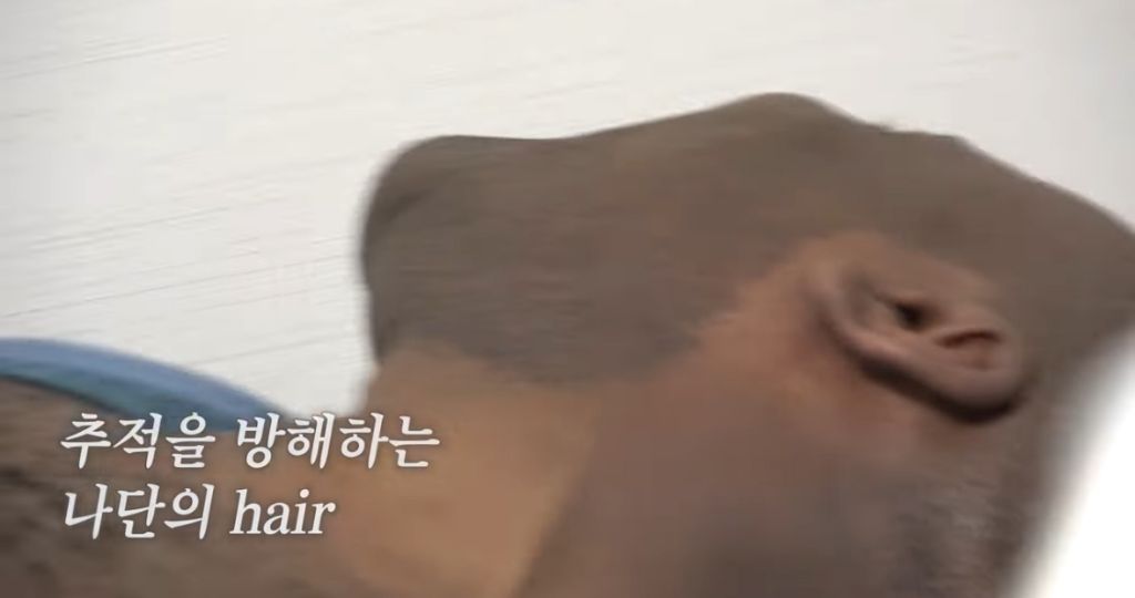 생각지도못한 조나단이 레이저 제모 못하는 이유 | 인스티즈