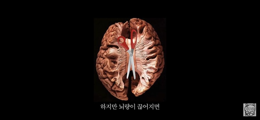 (스압)분리 뇌 실험 | 인스티즈