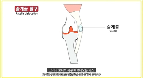 국내 소형견이 유독 슬개골 탈구가 많은 이유 | 인스티즈
