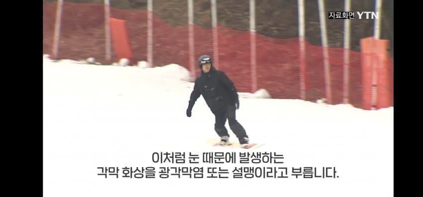 다들 겨울철 각막화상 조심하세요 | 인스티즈