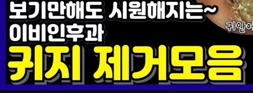 귀지 제거모음.zip | 인스티즈