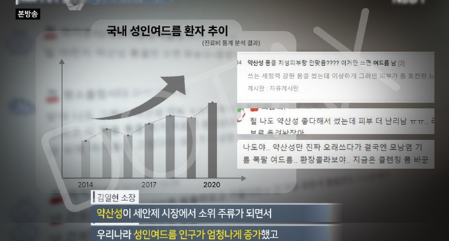 얼굴에 뭉치는 여드름 '산성피지'의 진실.jpg | 인스티즈
