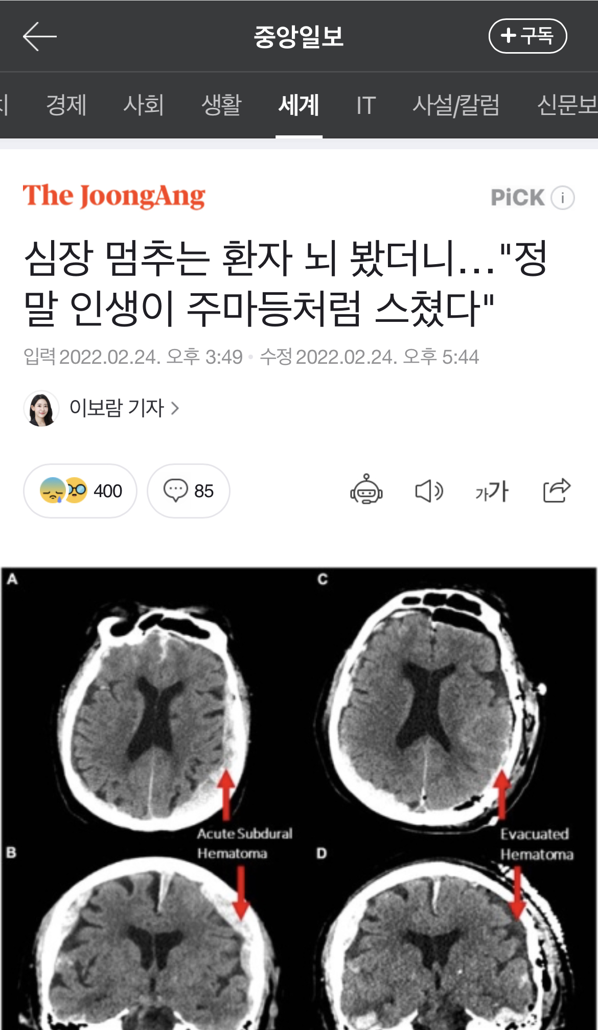 사람이 사망할때 뇌를 봤더니…"정말 인생이 주마등처럼 스쳤다" | 인스티즈