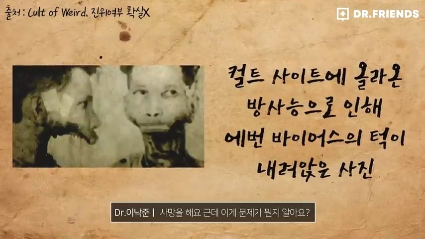 강한자도 살아남기 힘들었던 시대의 방사능 치료 | 인스티즈