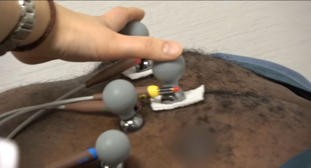 생각지도못한 조나단이 레이저 제모 못하는 이유 | 인스티즈