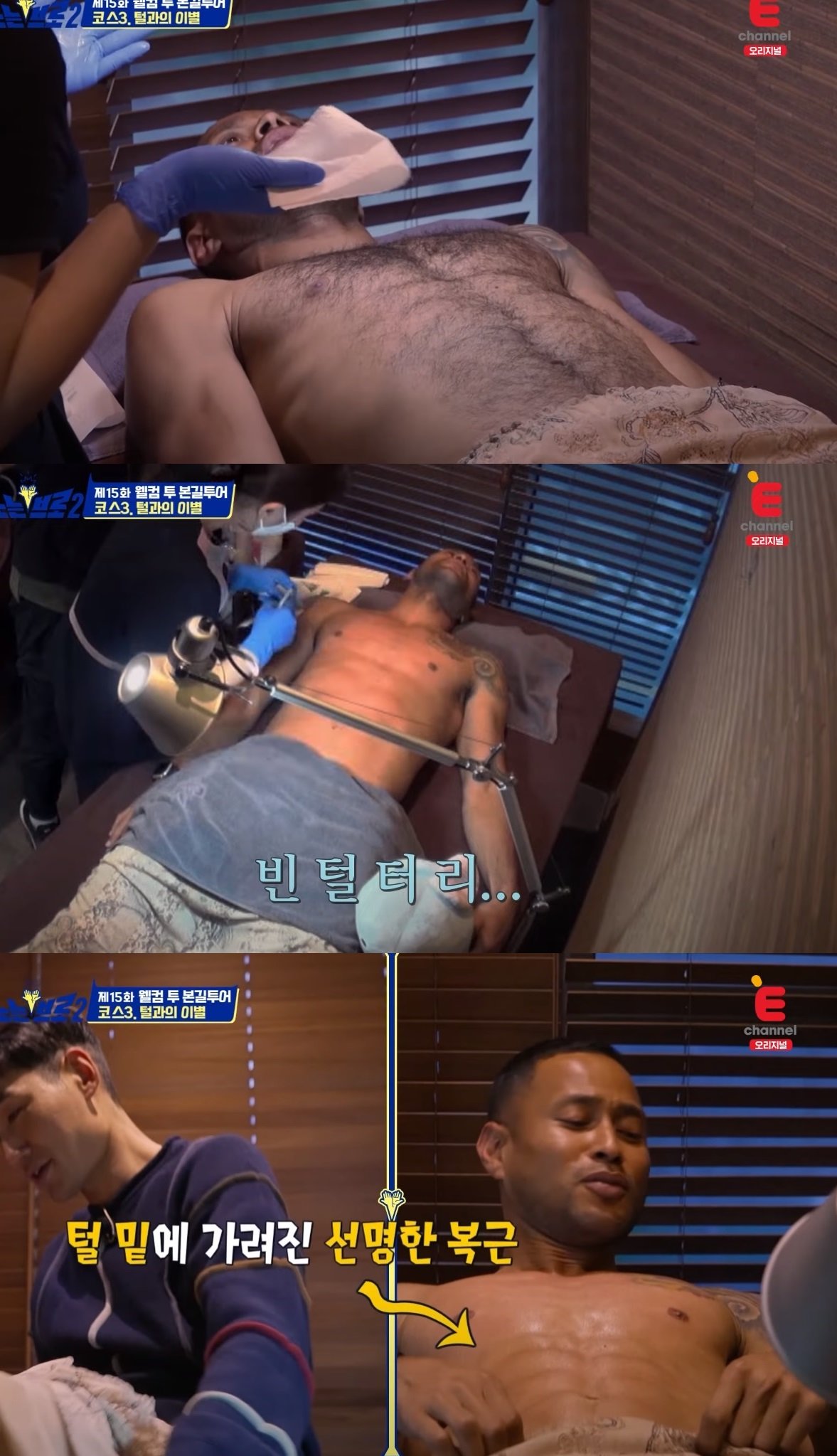 전태풍 왁싱 전후.jpg | 인스티즈