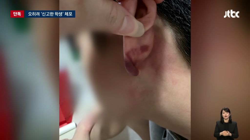 신고한 학생을 헤드록으로 제압해 체포한 경찰 | 인스티즈