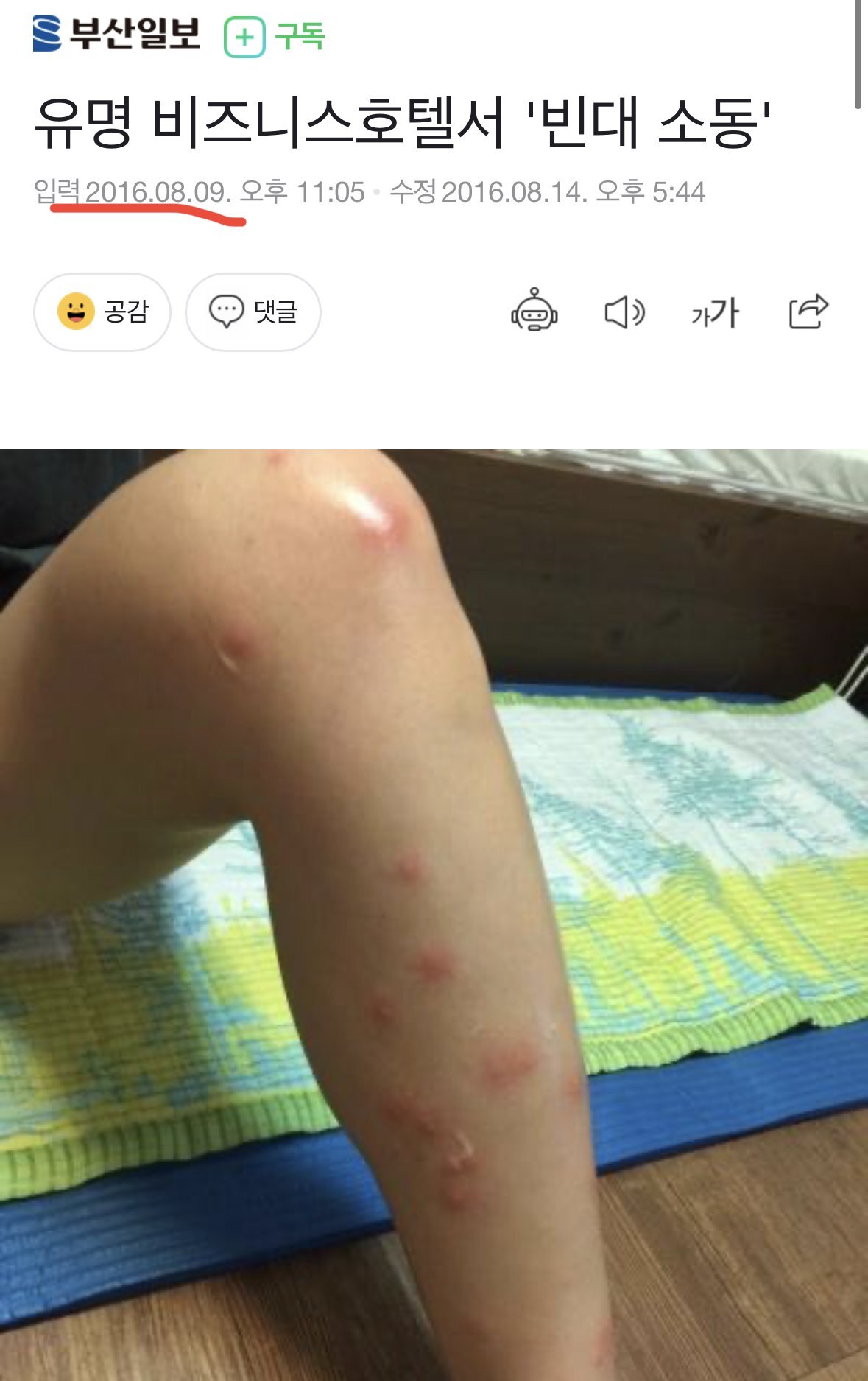 한국에서 멸종된 빈대가 갑자기 생긴 것일까? | 인스티즈