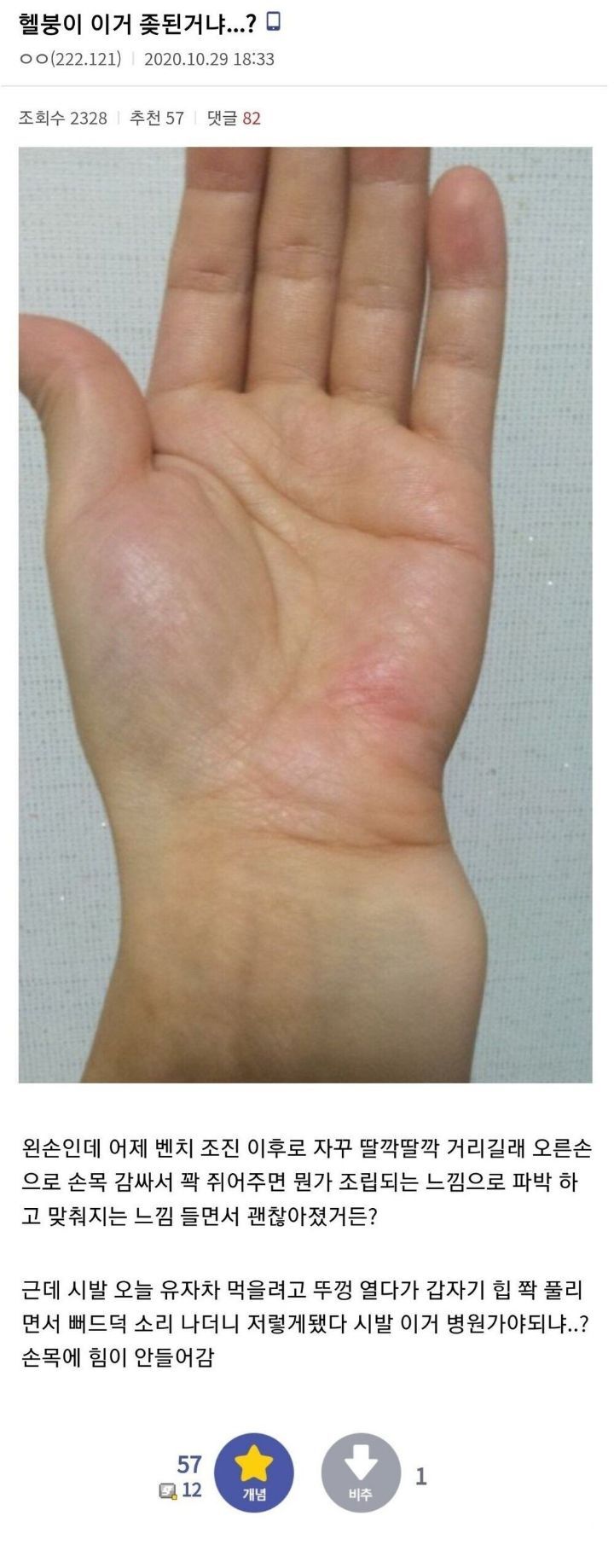 헬붕이 병원가야하나요? jpg | 인스티즈