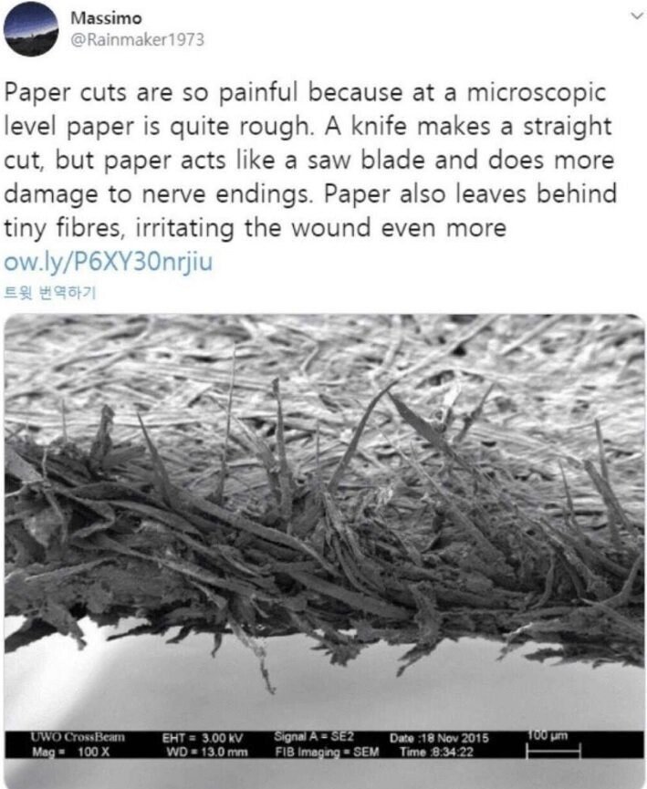 종이에 베이면 더 아픈 이유..jpg | 인스티즈