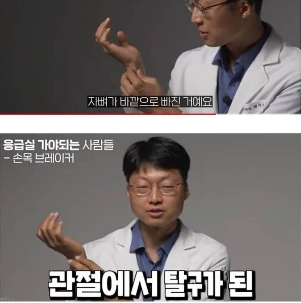 의사가 바라본 손목 브레이커.jpg | 인스티즈