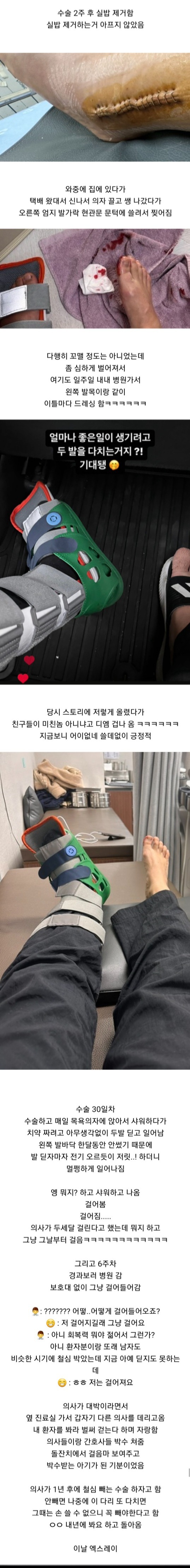 약혐주의) 어느 건강하고 회복력 아주 좋은 쾌녀의 발목뼈 부러진 후기 | 인스티즈