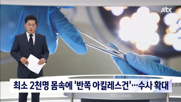 지난 7년간 십자인대 수술 받은 사람 중 무허가 인대 이식 받은 사람 최소 2천명 | 인스티즈