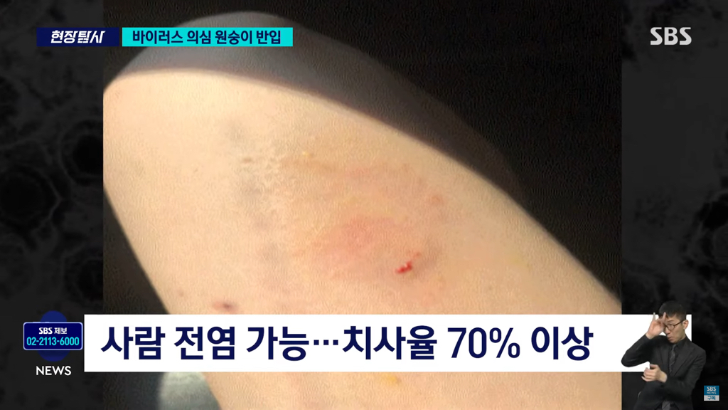 바이러스 의심 원숭이 반입 뉴스 | 인스티즈