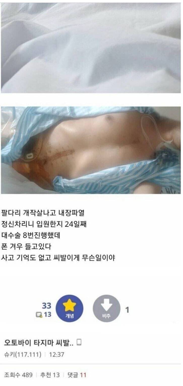 (혐오주의) 바이크 갤러리 사고 후기.jpg | 인스티즈