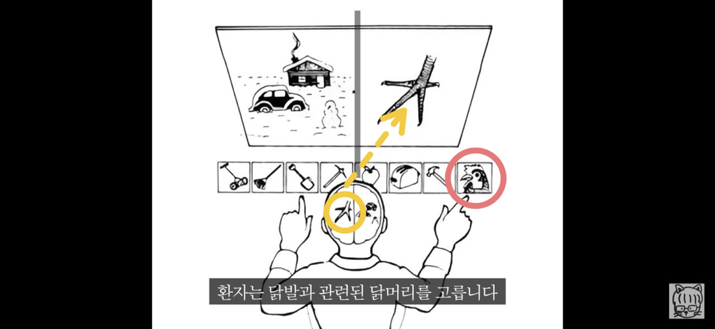 (스압)분리 뇌 실험 | 인스티즈