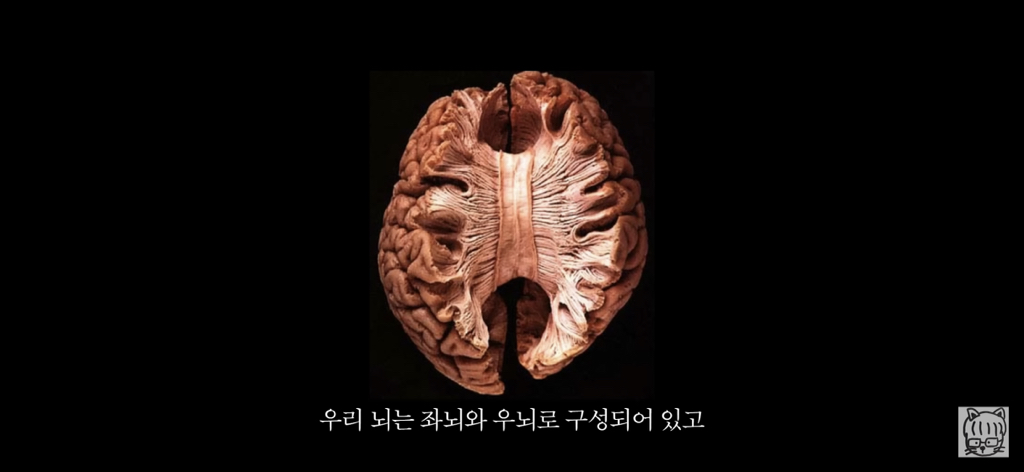 (스압)분리 뇌 실험 | 인스티즈