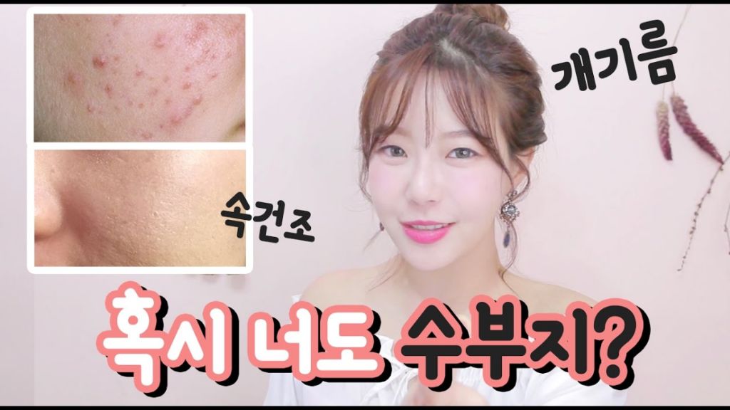 피부과 의사들이 말하는 최악의 피부타입 | 인스티즈