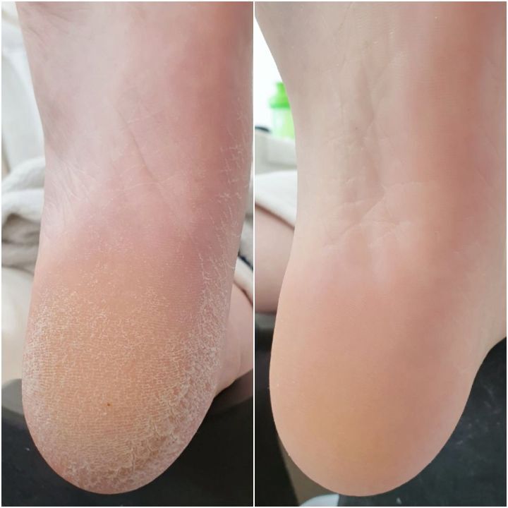 로제네일 이미지
