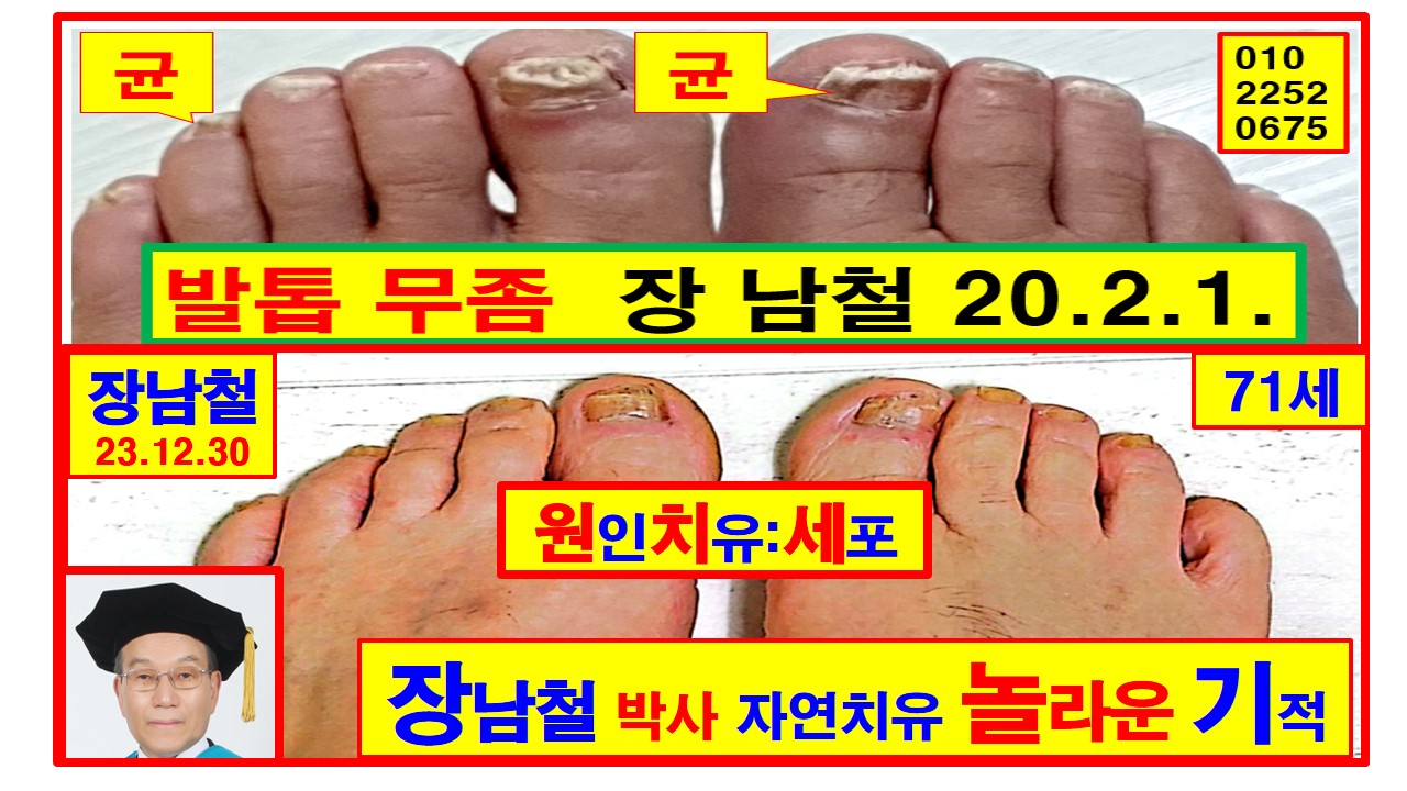 장*남 이미지