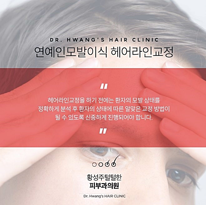 선헤어라인 이미지