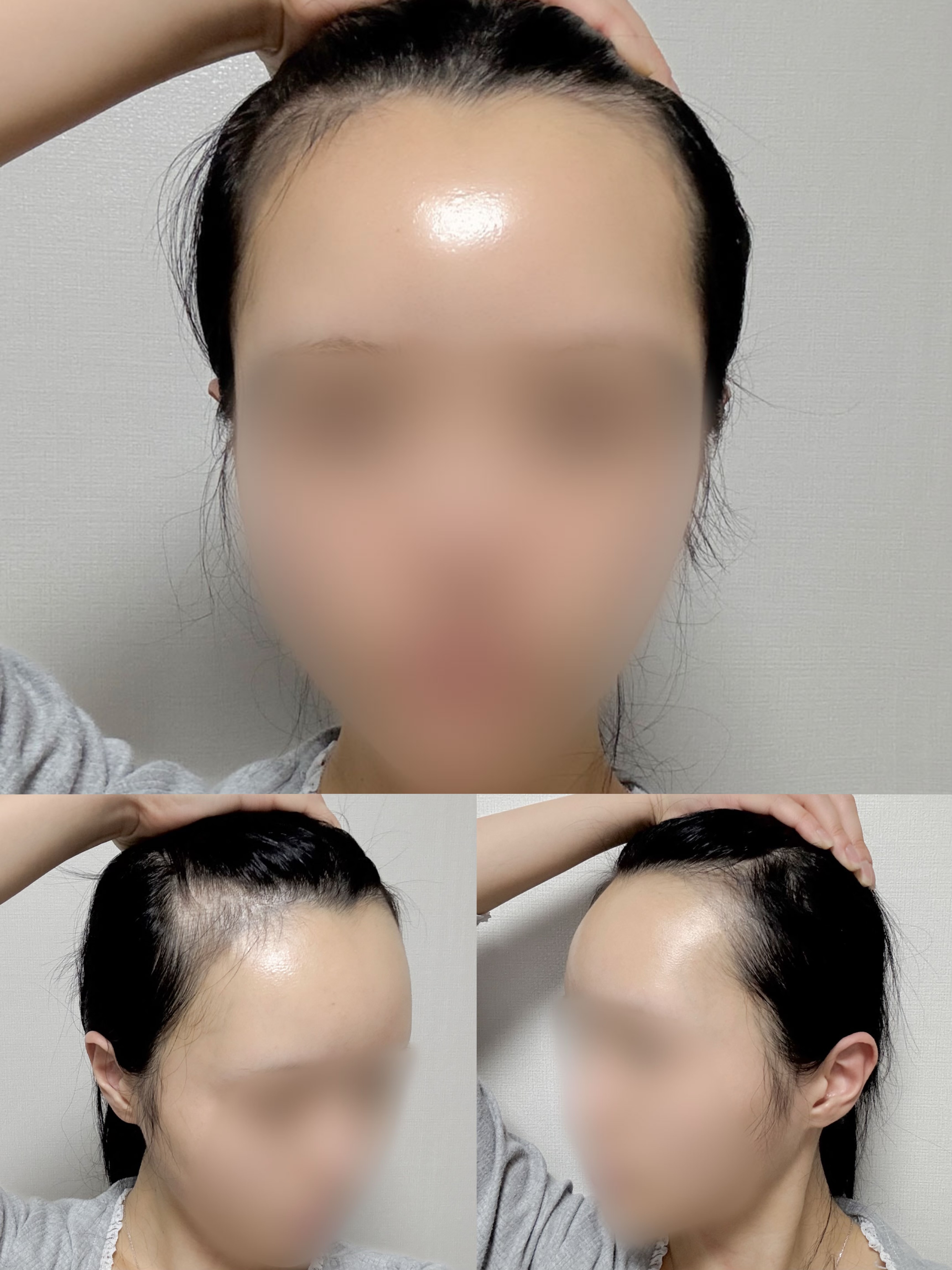 7cf418ef836ec352126fc453b32ecd517df4205f