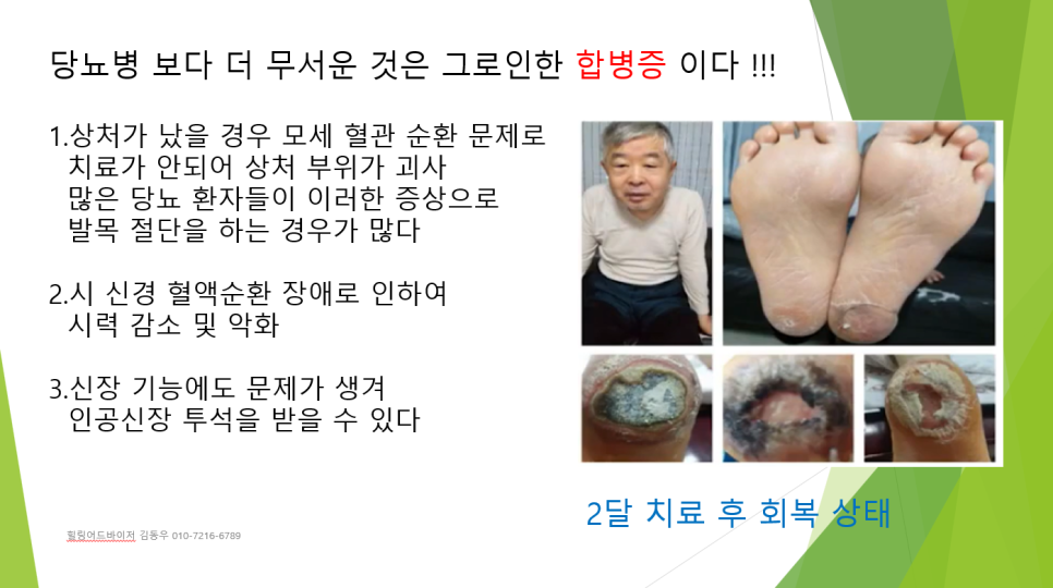 이다 이미지