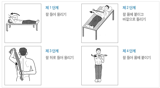 중앙마취통증의학과의원 | 동결견, 관절수동술 - Daum 카페