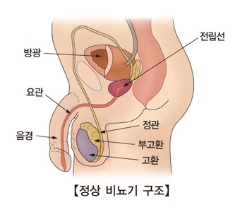 조루