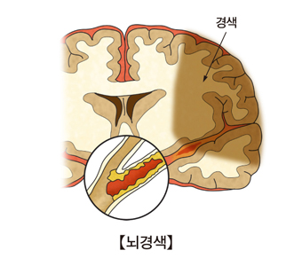 목부위