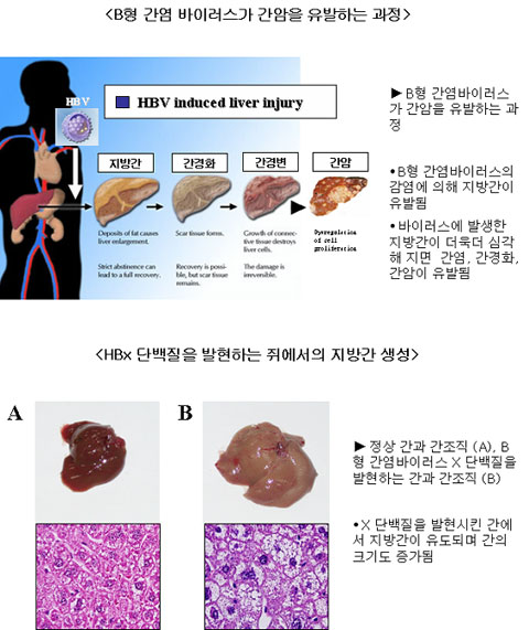 B형 간염바이러스 지방간 형성 첫 규명