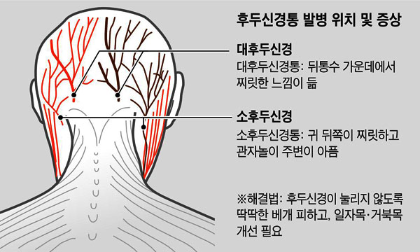 뒤통수 찌릿하고 관자놀이 통증.. 뒷목 신경 눌린 탓 뒤통수 찌릿하고 관자놀이 통증.. 뒷목 신경 눌린 탓