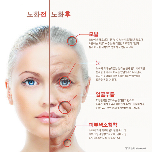 웰에이징 특집[① 피부노화] 피부나이도 건강하게..브라보! 마이 라이프