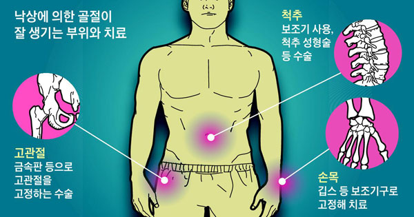 경미하게 금 간 뼈, 방치했다간 완전 골절·사망까지 경미하게 금 간 뼈, 방치했다간 완전 골절·사망까지