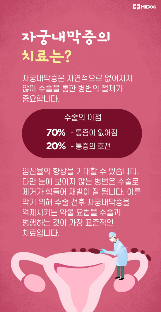 골반통, 생리통, 불임 부르는 '자궁내막증' 증상 골반통, 생리통, 불임 부르는 '자궁내막증' 증상