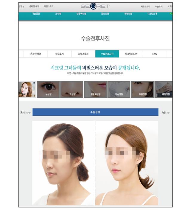 신데렐라성형외과의원 이미지