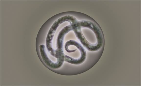 기생 선충의 새끼를 현미경으로 관찰한 모습. 볼바키아에 감염된 선충들은 볼바키아 없이는 새끼를 낳을 수 없다. 국립생태원 제공